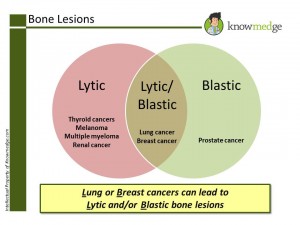 Bone Lesions