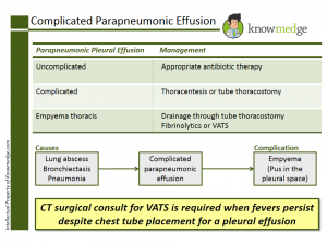 Pleural Effusion