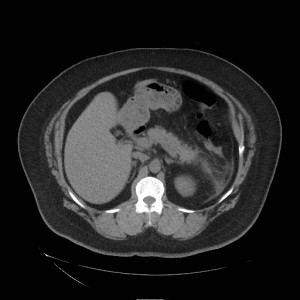 USMLE Step 1 Exam Question - Image Challenge