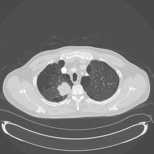 IM Boards Practice Question - CT Challenge