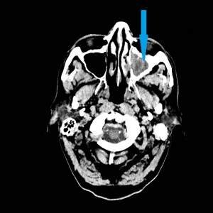 Board Exam Test Review Challenge Question - CT Head