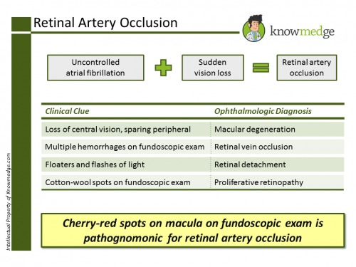 Internal Medicine Retinal Artery Occlusion