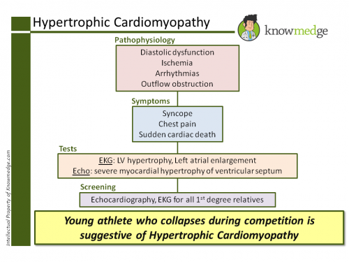 Hypertrophic Cardiomyopathy ABIM PANCE