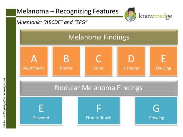 Melanoma Medical Mnemonics